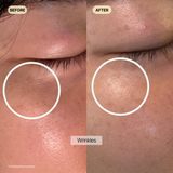 DeepLift Toner – Anti-Aging, Lifting, Firming