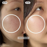 COLLAGEN FREEZE Mask Set - Anti-Wrinkle