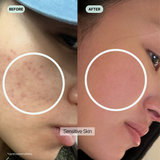 BarrierFix Serum - Calming